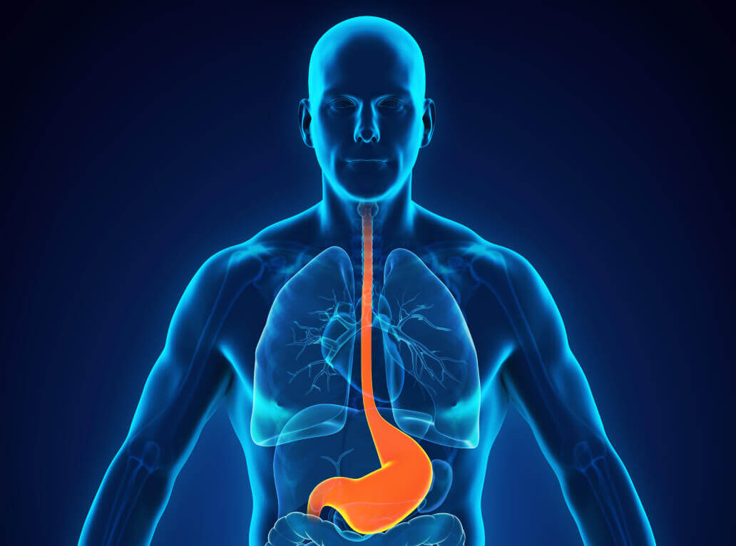 acid reflux